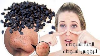 استعملي قناع الحبة السوداء وقولي وداعا للرؤوس السوداء والكلف والبقع البنية في بضع دقائق