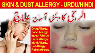 Allergy ka Ilaj | Skin/Dust Allergy | Pollen Allergy | Treatment URDU/HINDI | Hakeem Ahmad Farooq