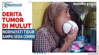 Derita TUMOR 2 KILOGRAM di Mulut, Norhayati Warga Banjarmasin Tidur Sampai Sedia Cermin