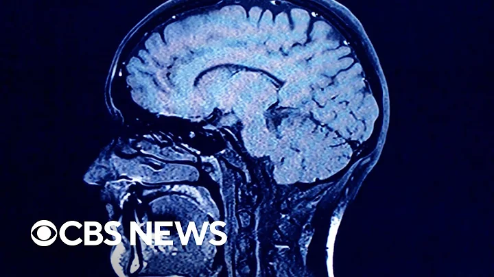 How long does the brain stay alive after death? (2023)