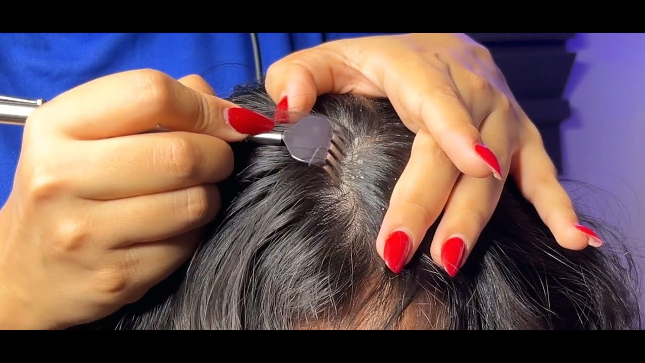Satisfying Dandruff Removal with Unique Tools 🧼✨ | Ultra Relaxing Scalp Cleaning ASMR