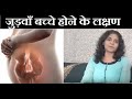 जुड़वाँ बच्चे होने का आसान तरीका - Twins Pregnancy and Symptoms