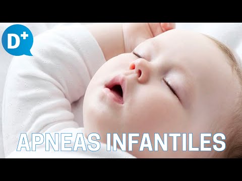 Vídeo: Apnea Del Sueño En Niños: Síntomas, Causas, Tratamiento Y Más