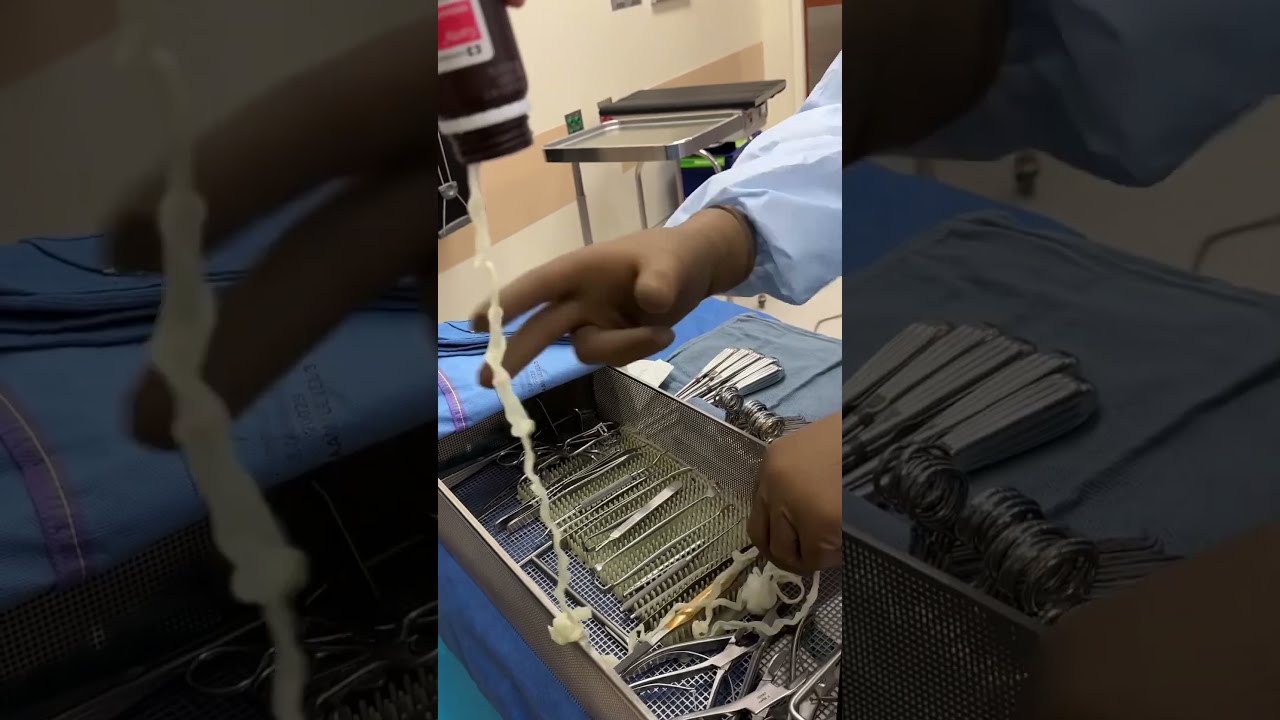 Packing Wounds Effective Treatment For Diabetic Foot Infections
