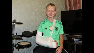 Уличный воркаут - Илья Варфоломеев - История о том Как я сломал руку