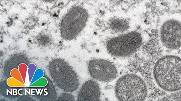 WHO Officials Say Monkeypox Outbreak Is 