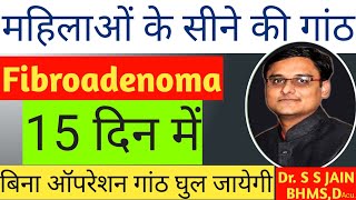 Fibroadenoma treatment, breast cancer, breast me ganth ka achuk ilaj, fat loss , belly fat