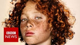 Celebrating freckles in all their glory - BBC News