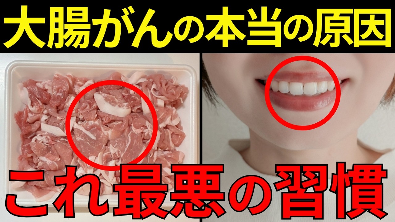 【衝撃の事実】日本人に多い大腸がんの意外な真犯人！原因から予防法まで徹底解説