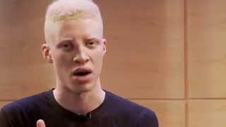 Кампания по повышению осведомленности об альбинизме - Шон Росс
