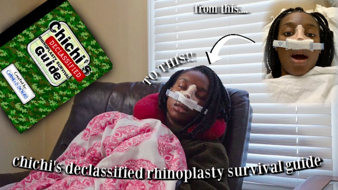 THE RECOVERY | Chichi Nose Best!