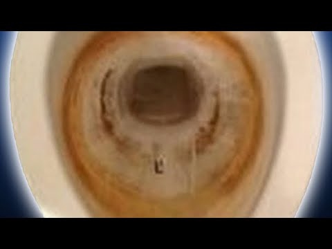 Hoe zich te ontdoen van toiletvlekken [2] | Hoe muriatinezuur te gebruiken om toiletpot schoon