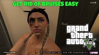 GTA5 BRUISES HOW TO GET RID OF THEM