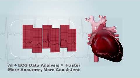 Wincomm AI ECG Solutions - Intel Medical Edge AI Market Ready Solutions