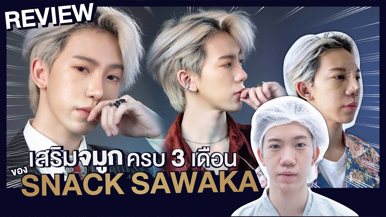 เสริม จมูก สไตล์ เกาหลี New 2022 รีวิวเสริมจมูกผู้ชายกับ snack sawaka ผลลัพธ์3เดือนจากจมูกชมพู่เรียวพุ่งเป็นoppa ที่someko