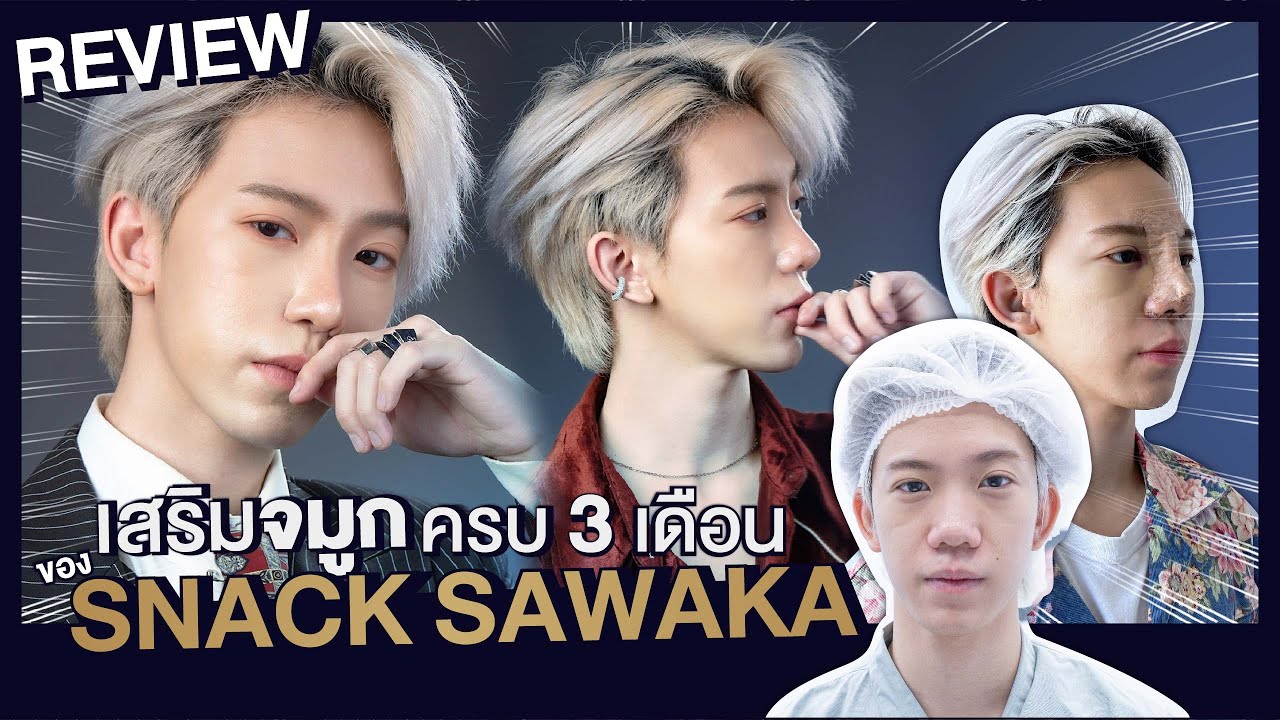 เสริม จมูก สไตล์ เกาหลี  New 2022  รีวิวเสริมจมูกผู้ชายกับ snack sawaka ผลลัพธ์3เดือนจากจมูกชมพู่เรียวพุ่งเป็นoppa ที่someko