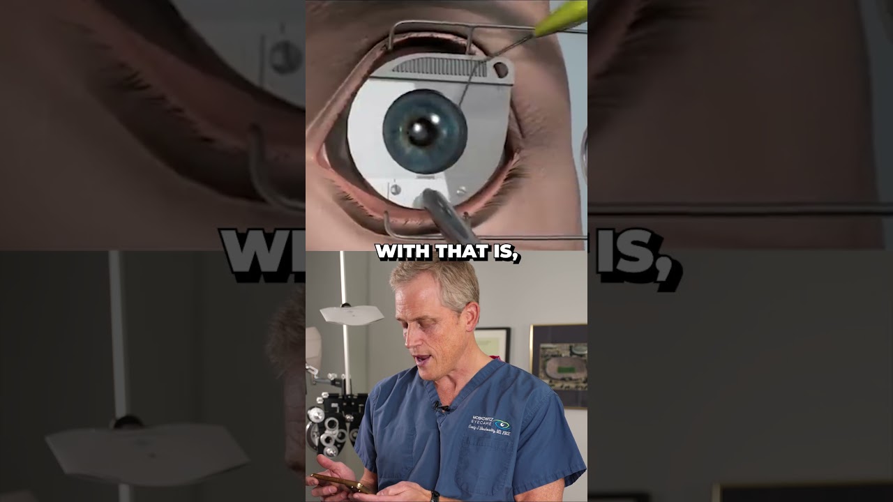 What really happens during LASIK eye surgery