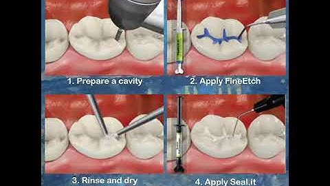 SPIDENT Seal it   Product introduction 1
