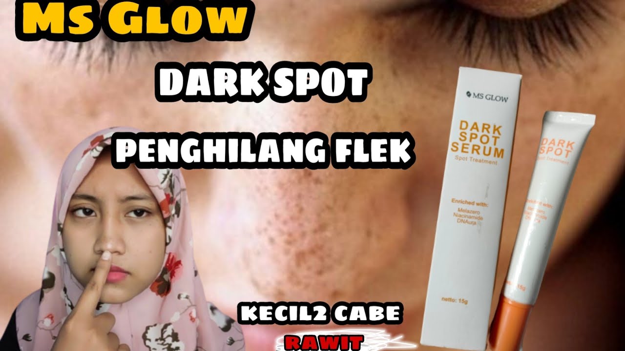 Cara Menghilangkan Flek Hitam di wajah Review ms glow dark spot