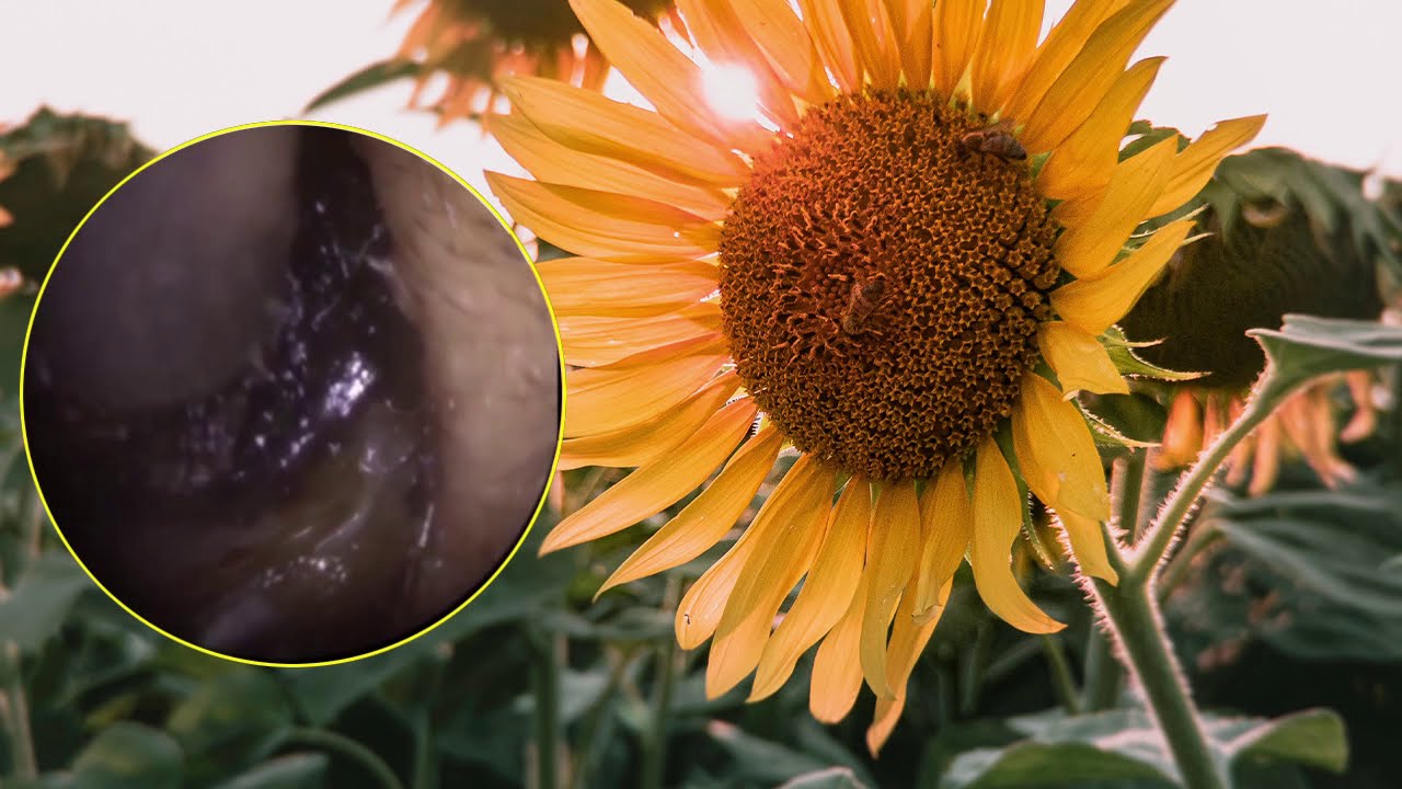 耳垢除去 007 ear wax removal 2020 YouTube