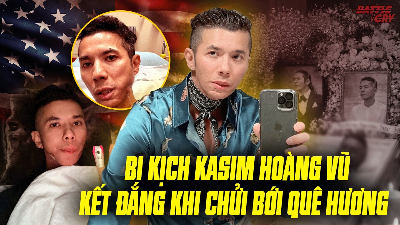 KASIM HOÀNG VŨ QUA ĐỜI TẠI MỸ - CÁI GIÁ ĐẮT CHO 1 LẦN NHỔ RĂNG VÀ CÁI KẾT CHÊ BAI CHỬI BỚI QUÊ HƯƠNG