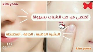 ماسكات للتخلص من حب الشباب (بشرة دهنية ، جافة ، مختلطة 