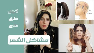 طرق علاج تساقط الشعر