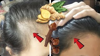 Mix Cloves with Ginger Indian Secret to Speed up Hair Growth and Get Rid of Baldness screenshot 2