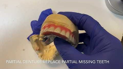 How does denture look like?