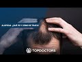 Alopecia  ¿Qué es y cómo se trata?