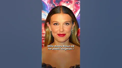 Millie Bobby Brown  before her plastic surgeries - DayDayNews