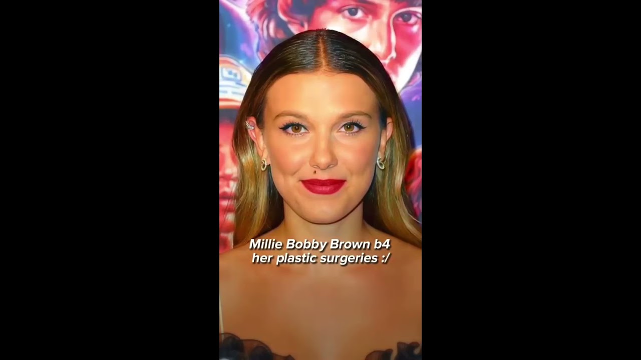 Millie Bobby Brown Before Her Plastic Surgeries