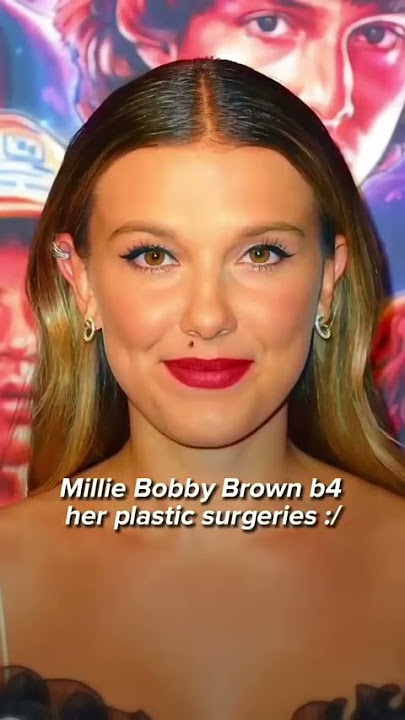 Millie Bobby Brown  before her plastic surgeries