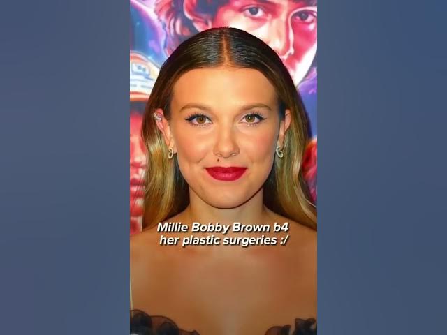 Millie Bobby Brown  before her plastic surgeries