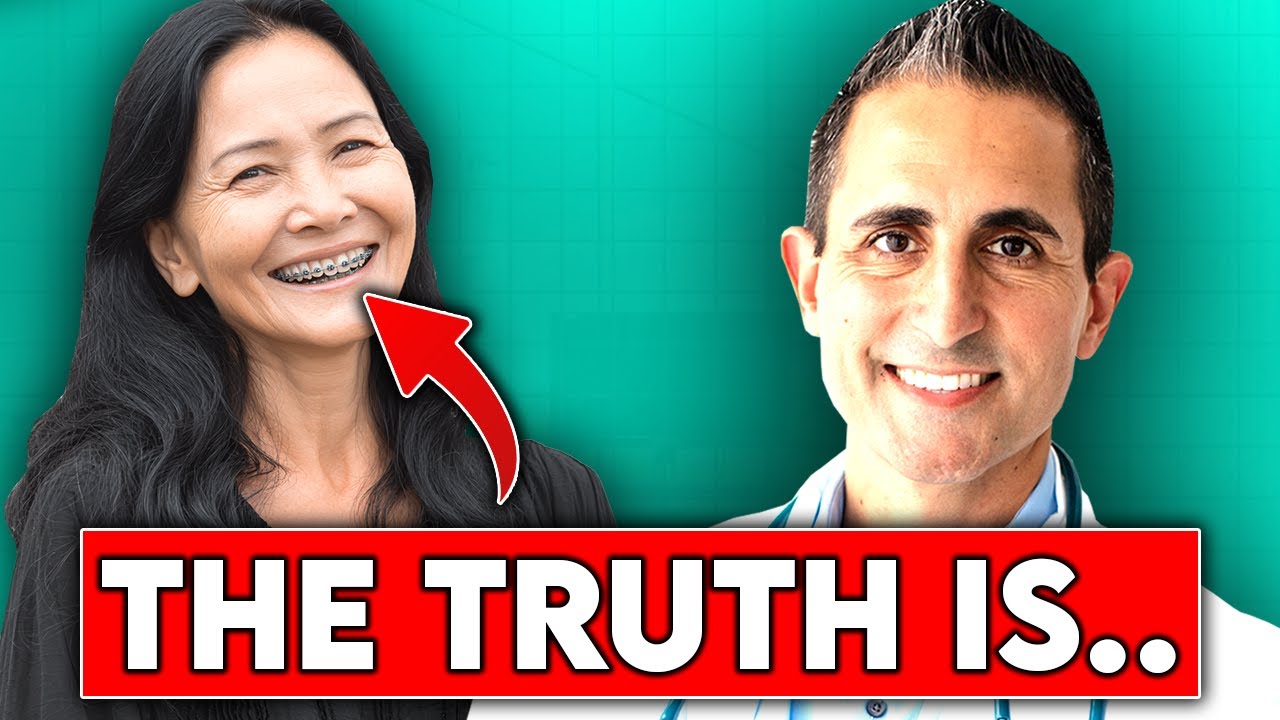 Планируете ставить брекеты во взрослом возрасте? Вот о чём обычно не говорят.