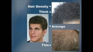 Properties and Disorders of the Hair and Scalp-Miladys
