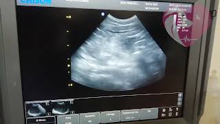 ultrasound (urinary crystals in a blocked tom cat)