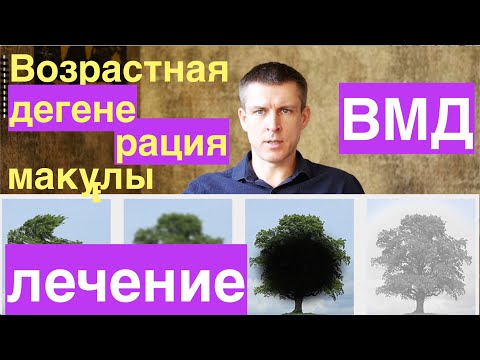 Видео: Работают ли инъекции при дегенерации желтого пятна?