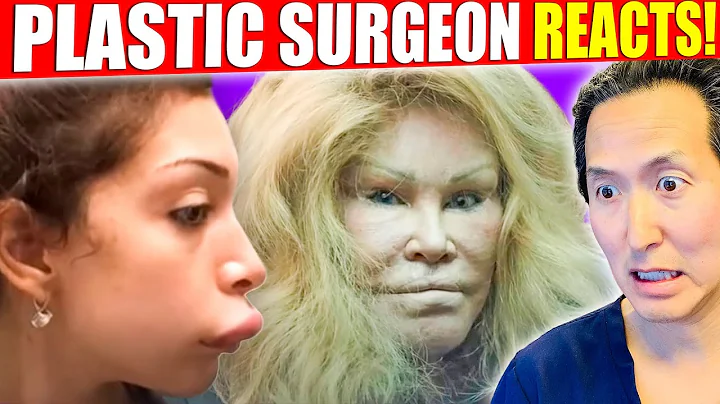 Plastic Surgeon Reacts to WORST Celebrity Surgery DISASTERS! - DayDayNews