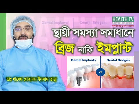 স্থায়ী সমস্যা সমাধানে ডেন্টাল ব্রিজ নাকি ইমপ্লান্ট? Dental Bridge vs Dental Implant | Dr Khaled
