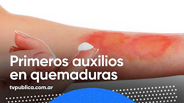 ¿Qué pomada es mejor para curar las quemaduras?