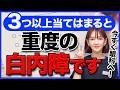 【今すぐチェック】この動画を見るだけでできる白内障重症度検査