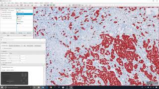 24 - Toggle displaying classes