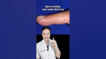 Nổi mụn nước ở tay do nhiễm trùng hay bệnh chàm tổ đĩa? #tips #shorts #bacsiluonghuyen #fyp #doctor