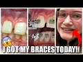Dental BRACES in New Braunfels: "I Got my Braces Today"