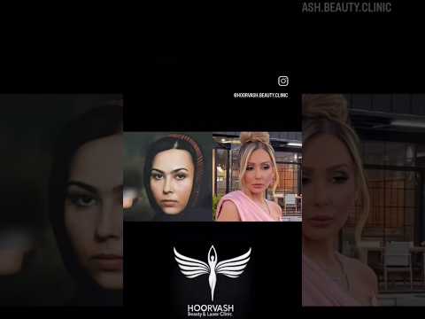 قبل و بعد شرکت کننده های عشق ابدی عشق ابدی پرستو صالحی   