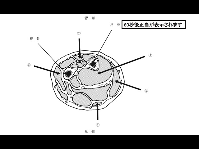 専門】第52回PT国試午後 No.30 - 骨盤帯付長下肢装具の適合判定