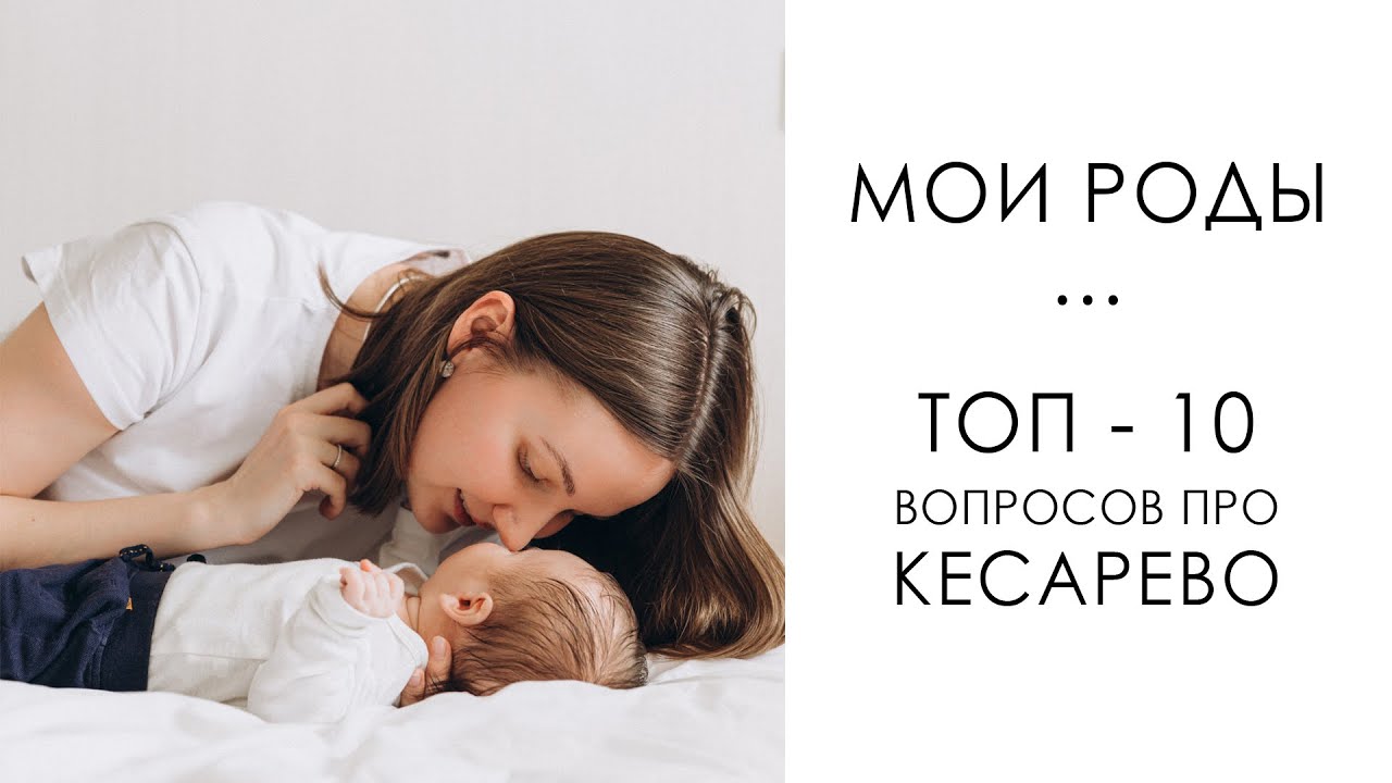 КЕСАРЕВО СЕЧЕНИЕ - БОЛЬНО/СТРАШНО?😱 РАЗРУШАЮ МИФЫ. МОИ РОДЫ