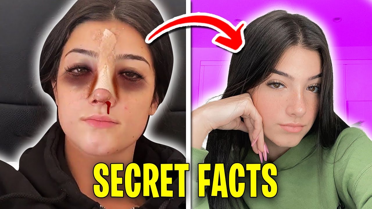 Secret Facts About Charli D’Amelio You NEVER Knew… YouTube