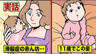 脳のシワが無い！滑脳症で生まれた赤ん坊...11歳でも身長40cm【マンガ動画】